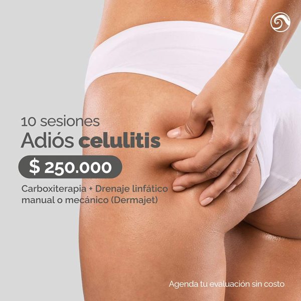 10 Sesiones Adiós Celulitis